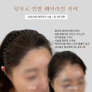 더모먼트 이미지