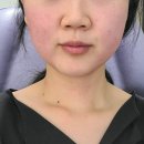 비티에프 이미지