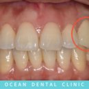 오션기공소 이미지