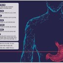 질병 &#34;위염 gastritis&#34; 이미지