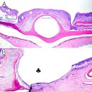 담수 머레이 대구의 만성 부식성 피부염(chronic erosive dermatopathy, CED) 이미지