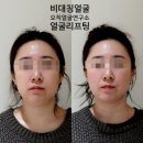 강남역리프팅 윤곽관리 비대칭관리 효과 확실한 오직얼굴연구소 서초점