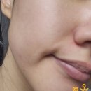 예쁨오 | 진해 에스테틱 라라필관리 예쁨온스킨