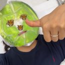 (주)동광레이저 | [시흥 미작뷰티] 기미`잡티 제거 후기, 관리방법 | 제로스팟 레이저 후기