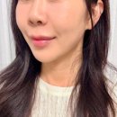 하니언니 | 신논현피부과 온다리프팅 6만줄 내돈내산 후기 언니가알려줄게