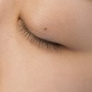 느리울헤어 | 대전 쥐젖 제거 편평사마귀,비립종 깔끔하게 해결