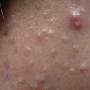 참맑은의원 이미지