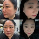 (주)테라파크 | 대전 도안동피부관리 추천｜서구 뷰티모아 페이스 테라노바 관리 솔직후기 | 산전 산후 신부관리