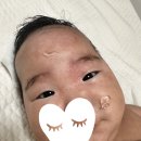 여름철 열많은 아기 판테딘 수딩젤 사용후 추천