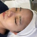 수원-1201 | [수원] 엑시드닝 화잘먹 피부관리 에이시 왁싱 후기