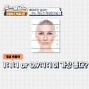 헤어라인교정 후기 수술 전후 꼭 체크해야 해보세요