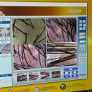 탑프라자 | 20대 여성 노원탈모관리 후기 탑스칼프노원점