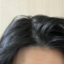 (주)에이디티캡스 판교지점 | 분당두피관리 분당탈모고민 | 독일 로하스모 판교센터 추천