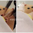 영테라피 이미지