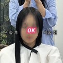 아띠부