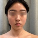 기흥 피부관리 추천! 헤라스킨케어에서 윤곽관리 수분관리 받은 후기