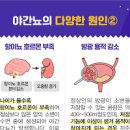 정상 소변량 하루 소변 횟수 자다가 소변 자주 마려움 왜 그런지 알아볼까 이미지