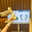 HS빌딩 | 대구 체형교정&amp;통증케어 추천 | 러닝 후 통증으로 &lt;HS운동센터&gt; 방문한 후기