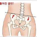 도수치료에 대해서 이미지