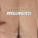 해피피부관리실 | 호계동피부관리 스킨리벨럽 1:1 맞춤 여름 수분관리 후기