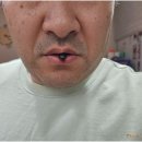 지아식품 | 40대 눈 영양제 아이틱스루지아, 일주일 복용 후기!