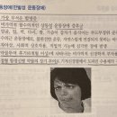 지연성 운동장애 기전 이미지