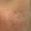 아이러브피부과의원 이미지