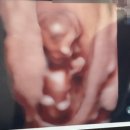 운정서울여성의원 이미지