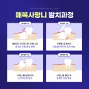 송도하버치과의원 이미지