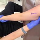 캐리랩 | 일산바디관리 캐리랩 고주파 팔뚝관리 후기