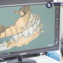 저스트치과기공소 이미지