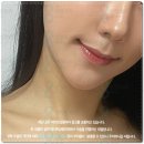 압구정페이스라인성형외과의원 | 압구정 피부과 울쎄라 600샷 선택 전 필독! 300샷 가격 대비 효과와 통증, 현실적인 유지 기간은?