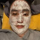피코토닝 효과 5회차 후기｜기미 잡티 개선 + V빔 홍조 레이저 같이 받은 변화 (내돈내산 3편)