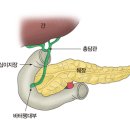 ﻿췌장암 (Pancreatic cancer) 이미지