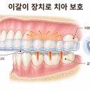 퍼스트치과기공소 네이버블로그