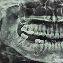 로뎀약국 | 구미 임플란트 내돈내산후기!옥계로뎀치과의원:원장님이 상담 진료하는 치과/ 치주질환전문