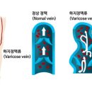 철다리 이미지