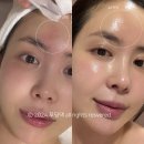 수원 영통피부관리 선에스테스파 광채 신부관리 만족해