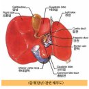 담석에 대한 모든 것 이미지