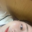 온아한한의원에서 손톱자국 흉터 조지는 새살침 1회차 맞은 후기