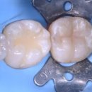 성복정원치과의원 이미지