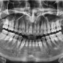 희망치과기공소 이미지