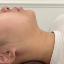 대전 가수원동 피부관리 : 루모어뷰티끄 (라인젯 이중턱관리)1회로 효과봤어요 !