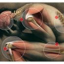 섬유근육통 증후군이란 무엇인가? 이미지