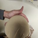 단두증 아기 하니헬멧 천안점 솔직후기