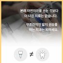 화이트드림치과의원 | 전체임플란트 완료 후 2~3년 차에 보철 높이가 달라진 느낌 든다면 점검해야 할 교합 변화 단계