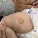 김세희소아과의원 네이버블로그