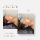 제주케어메디칼 | 대구신부관리 꿀팁! &lt;에르벨에스테틱 대구삼덕점&gt; 대구중구피부관리 후기 &amp; 대구피부자격증 수강