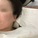 트리플메디칼 | LDM 리프팅 + RF 고주파 ㅣ 광주화이트태닝 한 번에 받고 놀란 후기✨