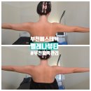 뷰티웨이브 | 부천팔뚝관리 '벨레나뷰티' 미친효과 온다 써마웨이브 리프팅 솔직후기
